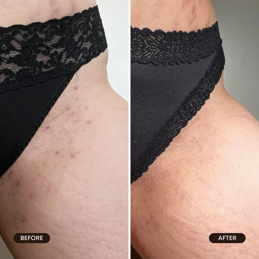 Cozy Cashmere Ingrown Hair Oil