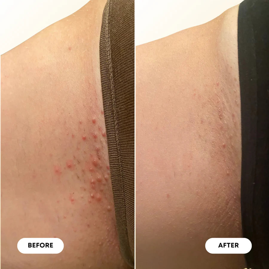 Milk & Honey Ingrown Hair Oil