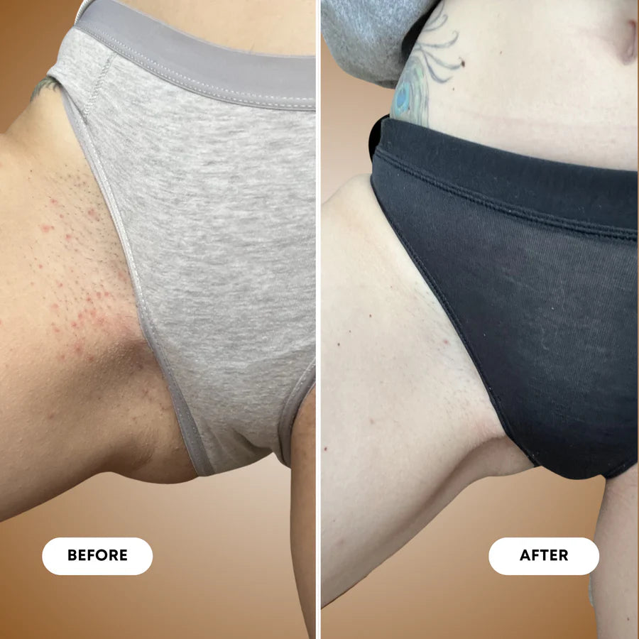 *PRE-ORDER* Vanilla Coconut Ingrown Hair Exfoliating Scrub