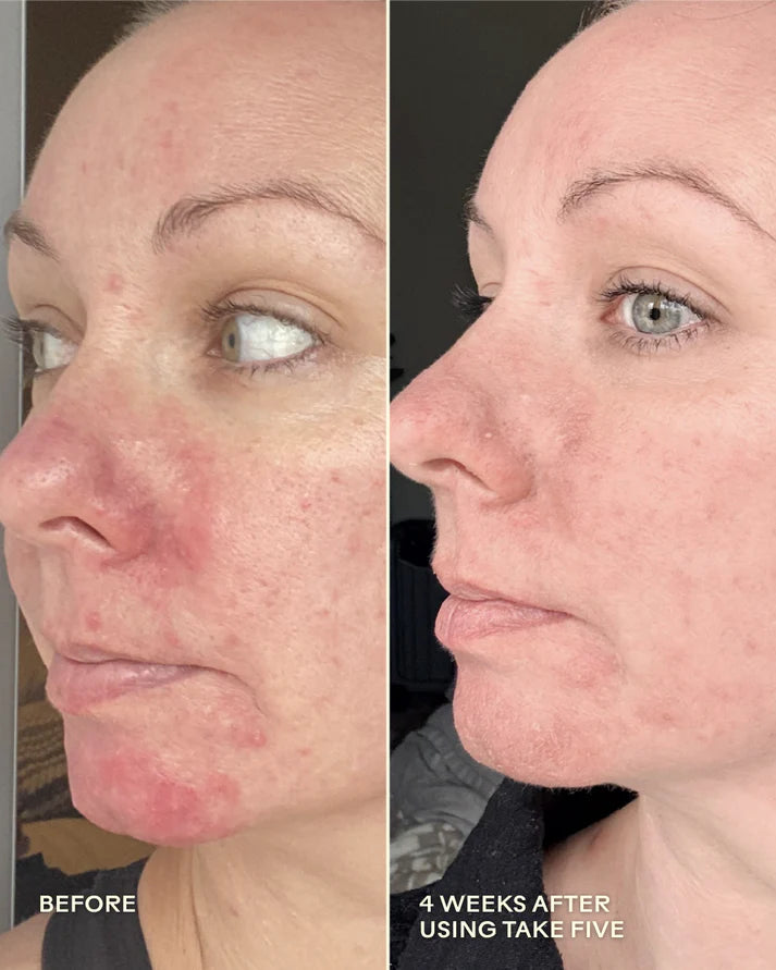Take Five™ Hypochlorous Acid Balancing Body + Face Spray