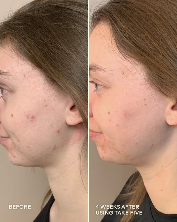 Take Five™ Hypochlorous Acid Balancing Body + Face Spray
