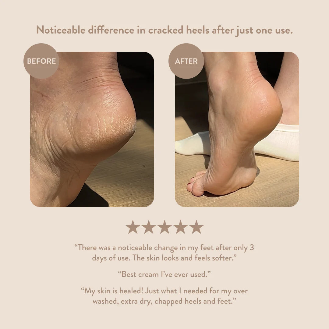 Mini Overnight Hand & Foot Hydration Mask