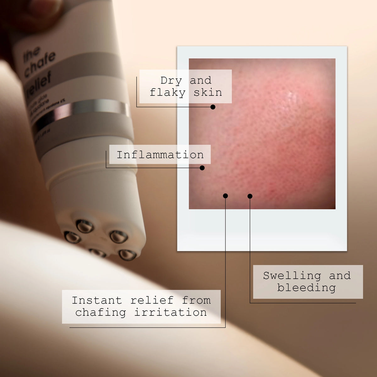 The Anti Chafe Relief Balm | Protective Barrier 6% Squalane